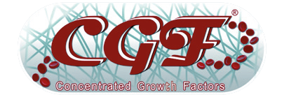 CGF (Concentrated Growth Factors) představuje moderní autologní regenerační metodu využívající vlastní růstové faktory pacienta pro podporu hojení, regenerace a omlazení tkání. Díky speciálnímu způsobu centrifugace vzniká vysoce koncentrovaný fibrinový matrix bohatý na růstové faktory, který nachází široké využití v estetické medicíně, stomatologii, implantologii i regenerativní terapii. Metoda CGF je ceněna pro svou bezpečnost, biologickou kompatibilitu a schopnost přirozeně stimulovat tvorbu kolagenu, cév a obnovu tkání.